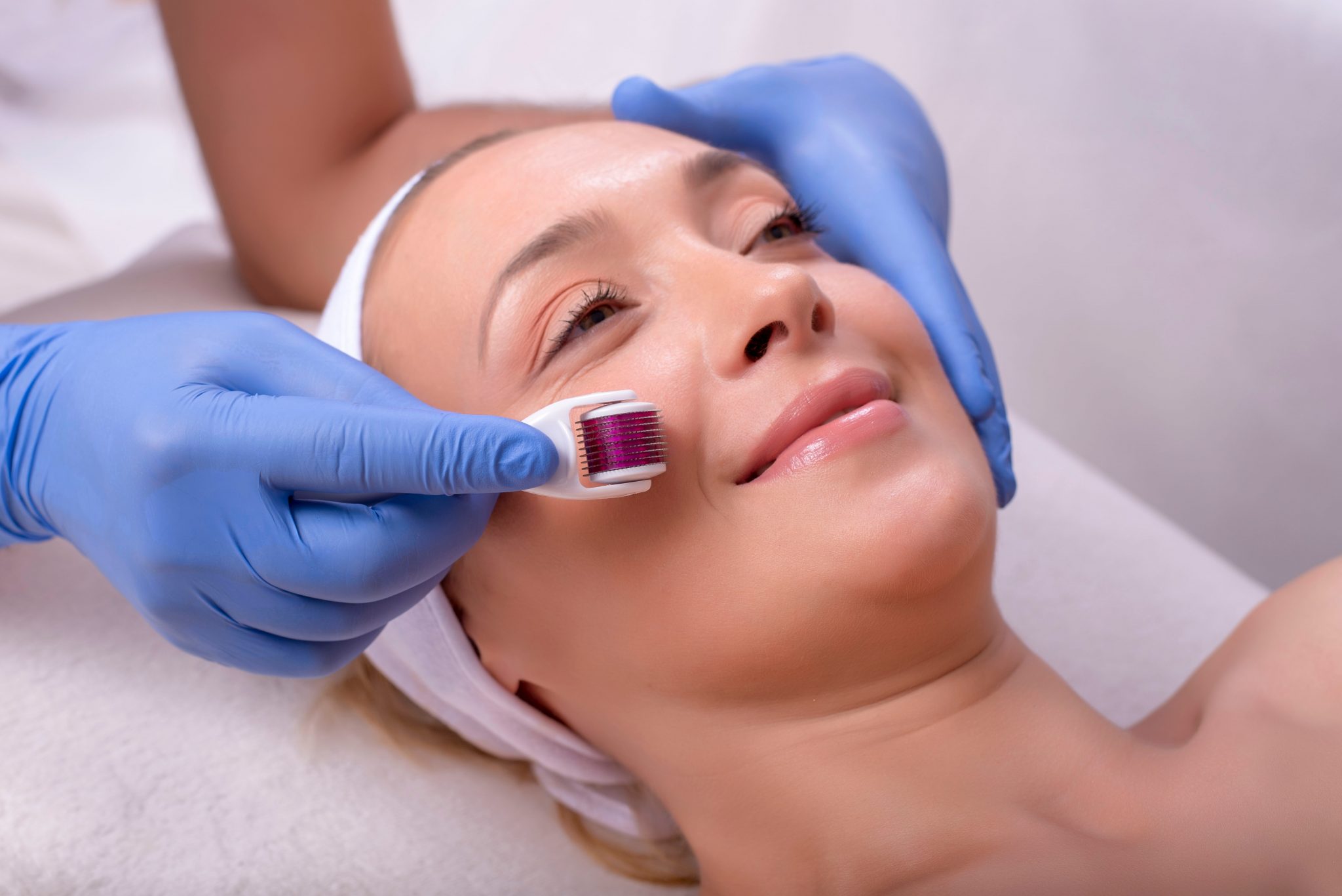 Tratamiento para el rejuvenecimiento facial con dermarrollers y el uso de ácido hialurónico